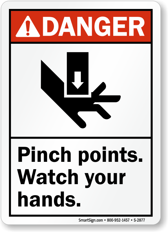 Keep point. Знак Pinch point. Watch your hands плакат. Pinch point Machine. Pinch point Safety.